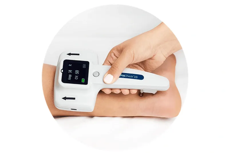 DPNCheck nerve conduction device placed at the ankle during a nerve assessment